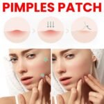 Best Hydrocolloid Acne Patches (2026) – Professional Blemish Repair & Clear Skin Kit - Image 3