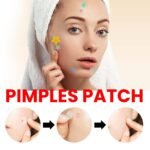 Best Hydrocolloid Acne Patches (2026) – Professional Blemish Repair & Clear Skin Kit - Image 5