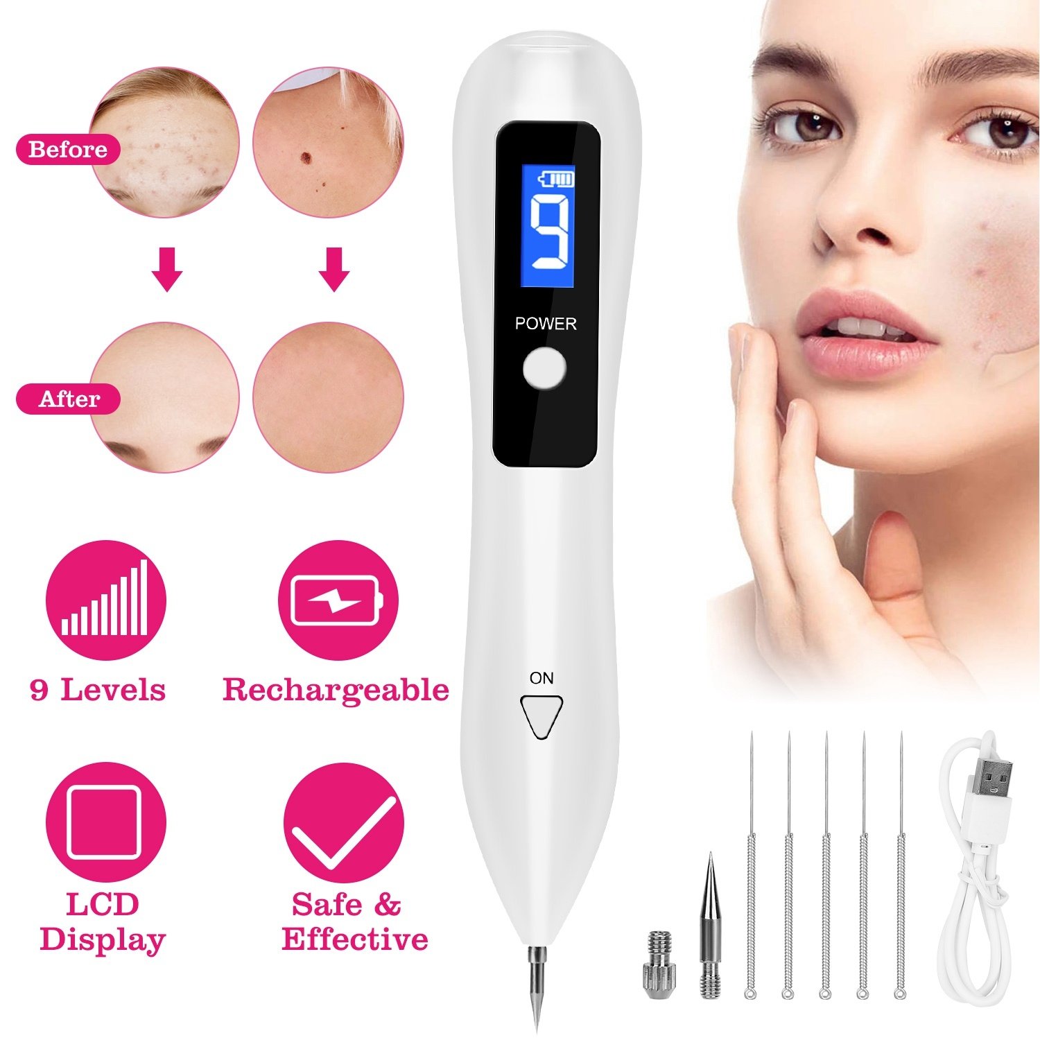6f1fd43b-dc9f-4924-8a91-3ec59af9be5c.jpg Skin Tag Repair Kit Portable Beauty Equipment Multi-Level With Home Usage USB Charging LCD Level Adjustable 6 Replaceable Needles - Image 1