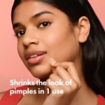 Premium Hydrocolloid Acne Treatment (2026) | Rapid Blemish Removal - Image 2